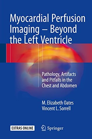 Read Myocardial Perfusion Imaging - Beyond the Left Ventricle: Pathology, Artifacts and Pitfalls in the Chest and Abdomen - M. Elizabeth Oates | PDF