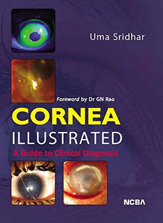 Full Download CORNEA ILLUSTRATED: A GUIDE TO CLINICAL DIAGNOSIS - Uma Sridhar file in PDF